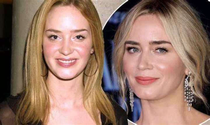 Emily Jackson Plastic Surgery: Before And After Photos