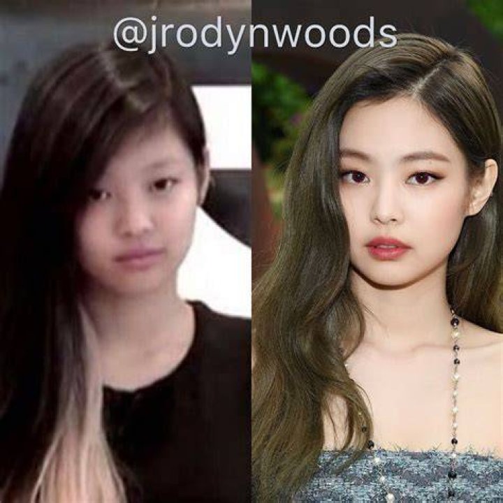 Jennie Kim | Plastic Surgery | Before And After