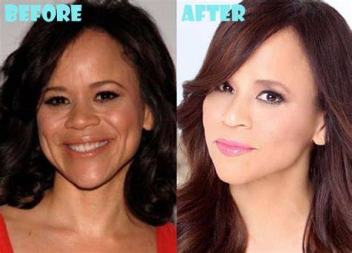 Rosie Perez Plastic Surgery Before and After