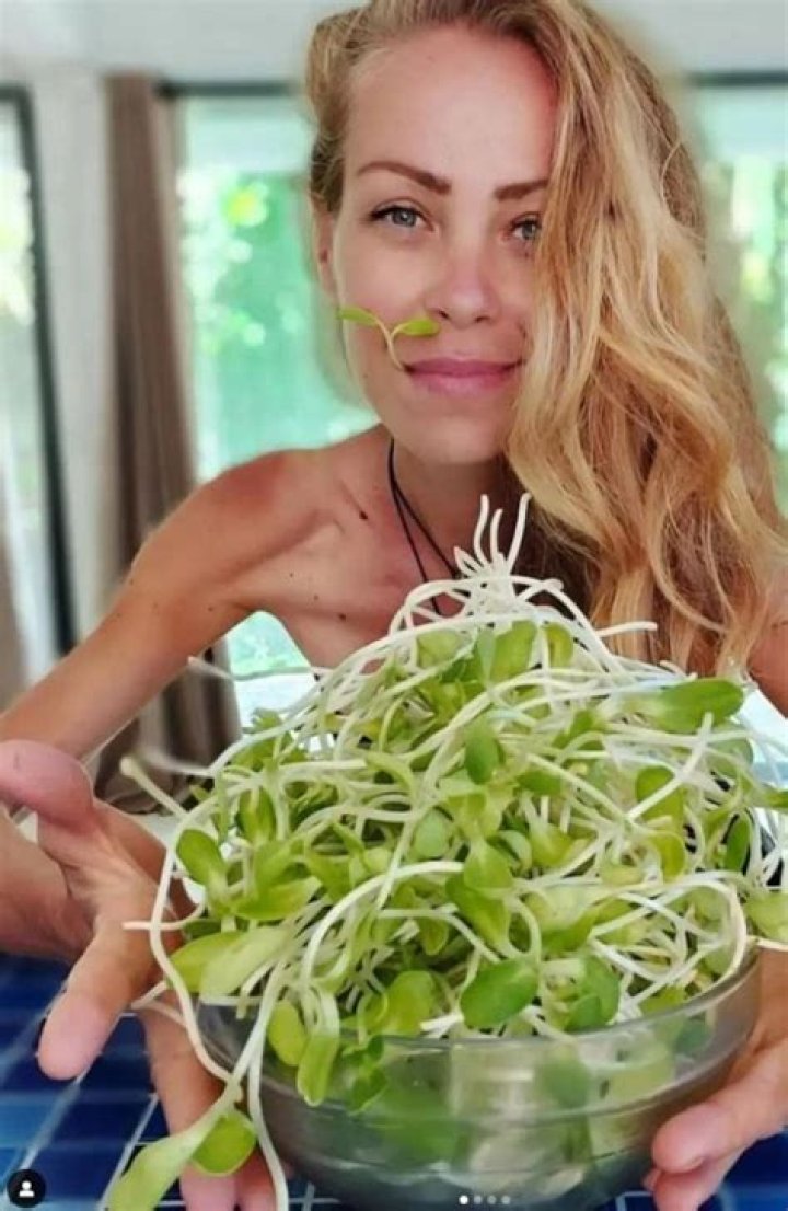 Zhanna Samsonova Anorexia
